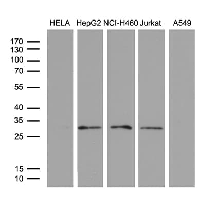 PSMD9 / 26S Proteasome Antibody (clone OTI5H2)