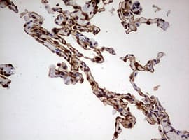 KRT7 / CK7 / Cytokeratin 7 Antibody (clone OTI1C5)
