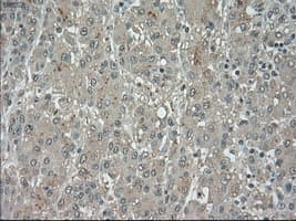 Monoclonal Mouse anti-Human BUB1B / BubR1 Antibody (clone OTI10B7, IHC, IF, WB)