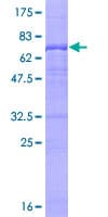 Human UBE3C Protein (Recombinant GST)