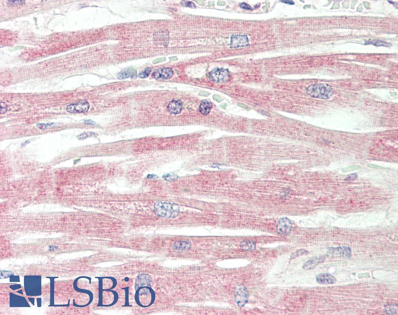 Polyclonal Rabbit anti-Human ICA69 / ICA1 Antibody (aa74-123, IHC, WB)