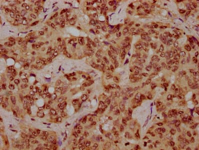 HIST1H1C Antibody