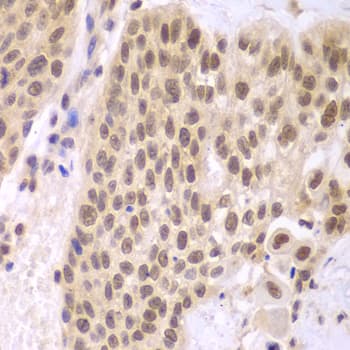 CSNK2A2 Antibody