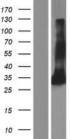 FCN2 / Ficolin-2 Protein (Over-Expression Lysate Myc-DDK (Flag))