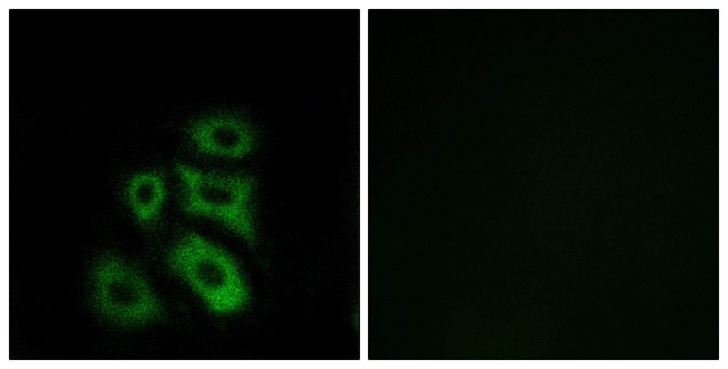 CLIP3 Antibody