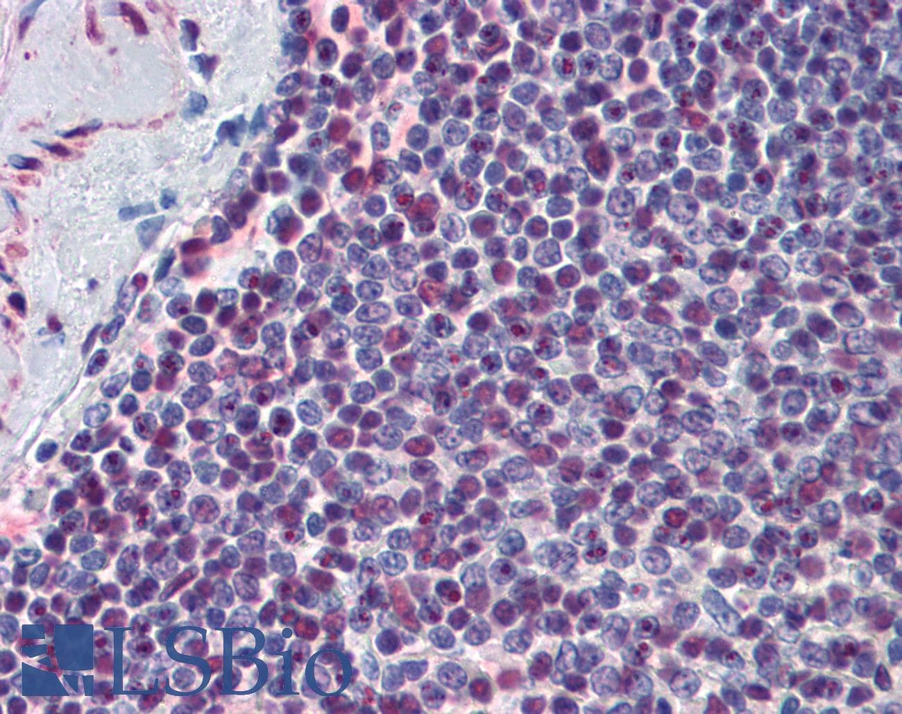 IHC-plus™ EP300 / p300 Antibody (clone 1D2)