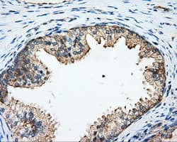 ARHGDIA / RHOGDI Antibody (clone OTI1A7)
