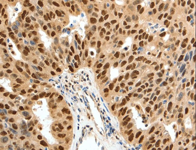 SSB / La Antibody