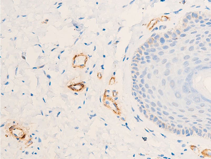 ACTA2 / Smooth Muscle Actin Antibody