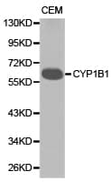 Polyclonal Rabbit anti-Human CYP1B1 Antibody (IHC, WB)