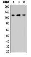 Polyclonal Rabbit anti-Human ITGA8 / Integrin Alpha 8 Antibody (C-Terminus, WB)