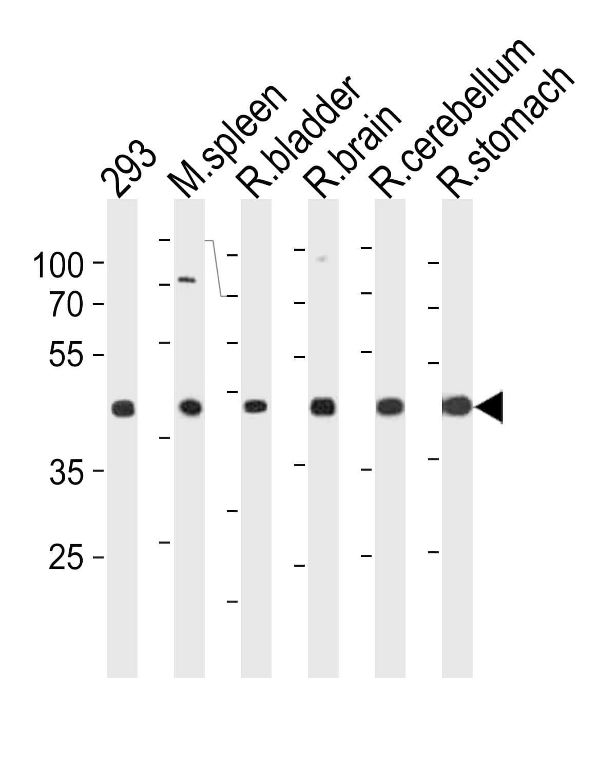 CCDC89 Antibody (aa114-145)