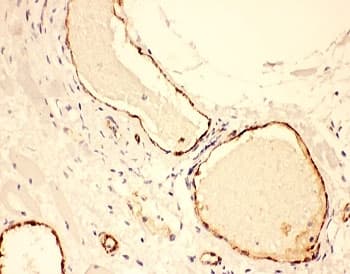 Polyclonal Rabbit anti-Human VWF / Von Willebrand Factor Antibody (aa2535-2813, IHC, WB)
