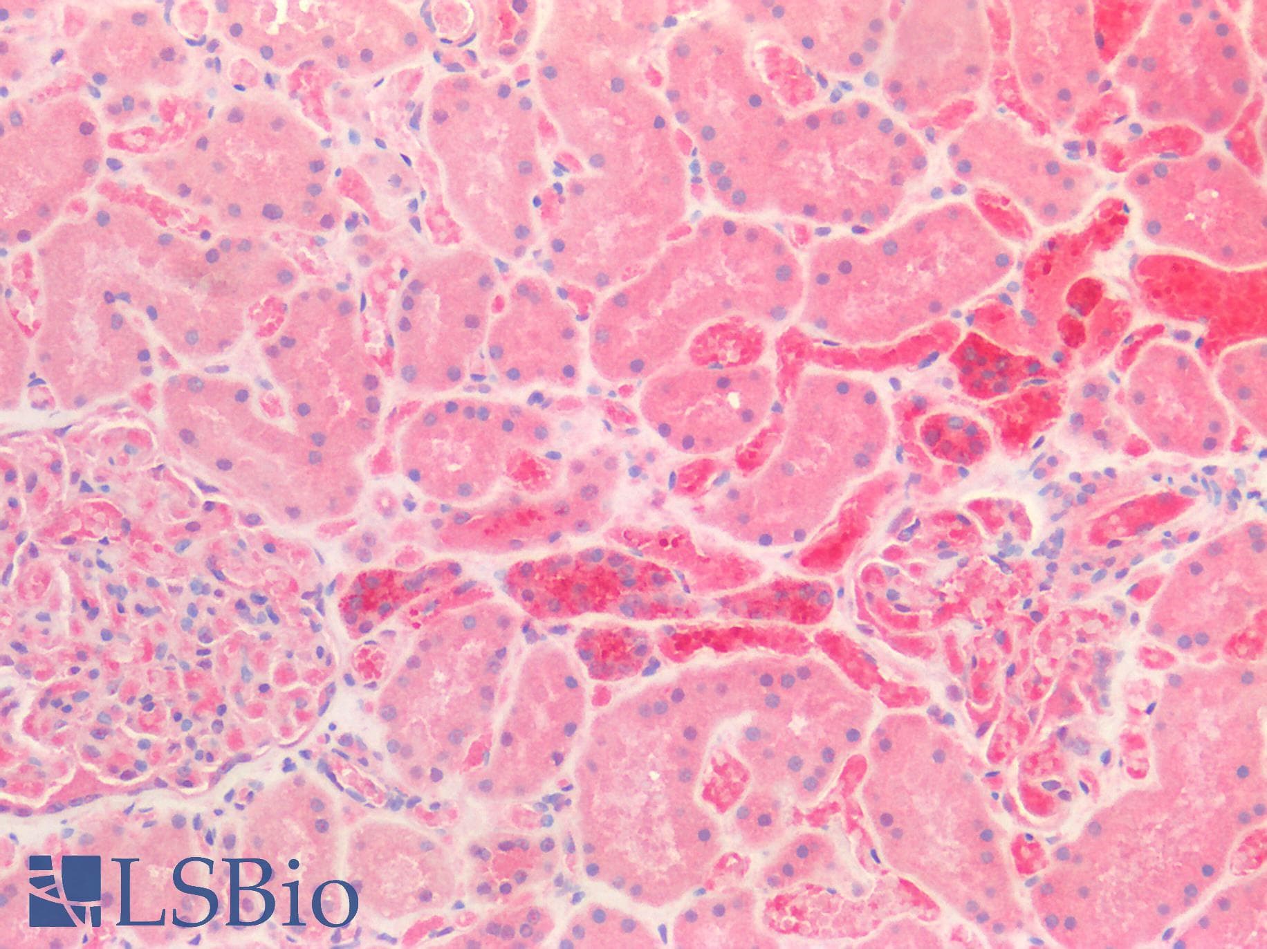 IHC-plus™ CALB1 / Calbindin Antibody