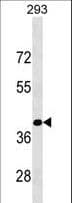 KLF15 Antibody (aa372-398)