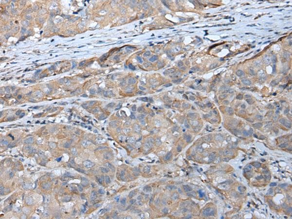 GPC5 / Glypican 5 Antibody