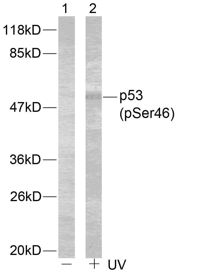 TP53 / p53 Antibody (phospho-Ser46)