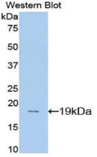 MDK / Midkine Antibody (aa22-140)