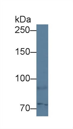ABCB2 / TAP1 Antibody (aa525-808, APC)
