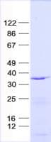 Human SLC25A31 Protein (Recombinant His, N-Terminal)