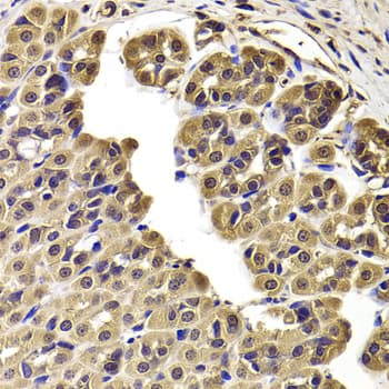CCT2 / CCT Beta Antibody