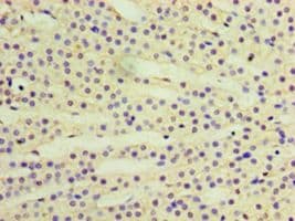 RAB6A / RAB6 Antibody (aa2-208, HRP)