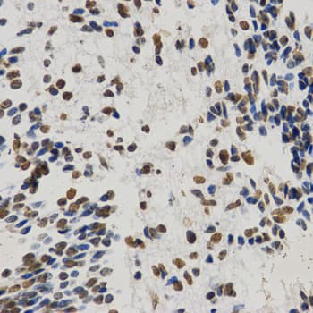 Polyclonal Rabbit anti-Human Histone H3 Antibody (Methyl-Lys9, IHC, IF, WB)