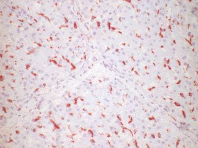 CD163 Antibody
