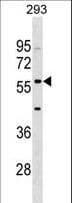 ISG54 / IFIT2 Antibody (aa307-335)
