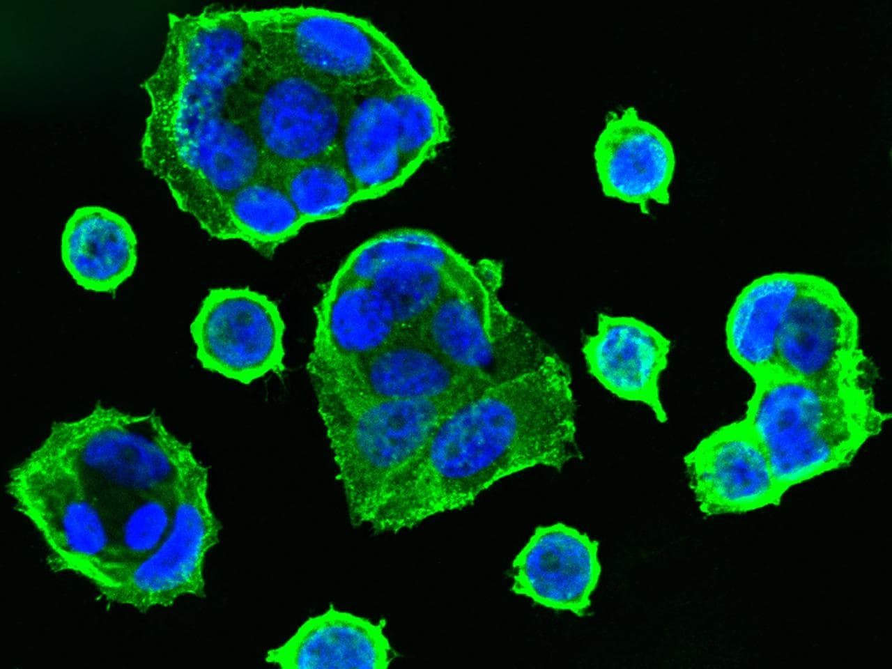 CDH1 / E Cadherin Antibody (Preservative Free)