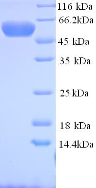 Human MYLIP / IDOL Protein (Recombinant His)