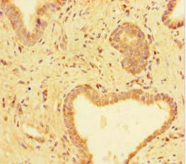 TUBA1C / Tubulin Alpha 1C Antibody