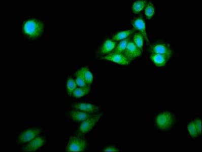 Neurochondrin Antibody