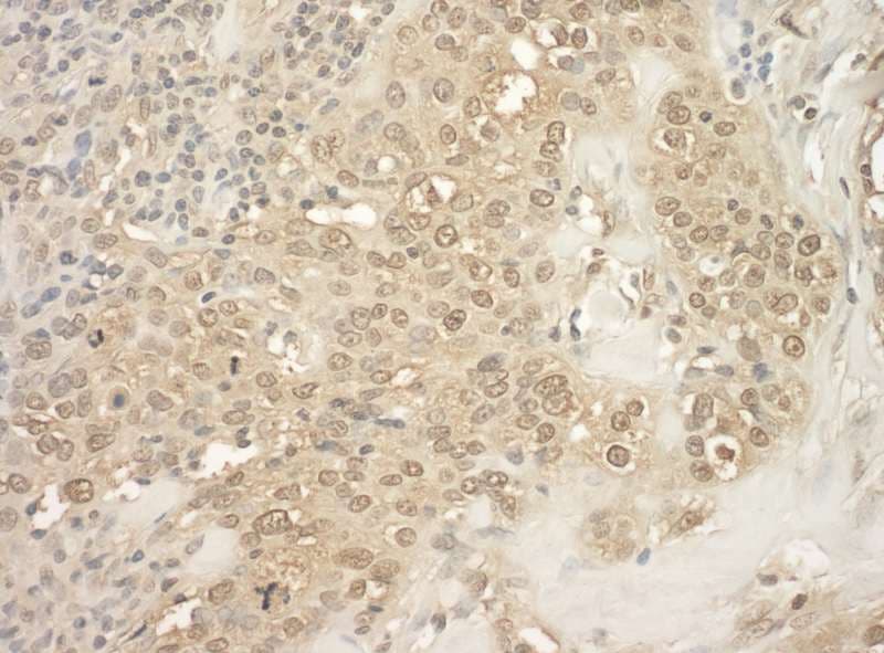 MAPKAPK5 / PRAK Antibody (aa423-473)