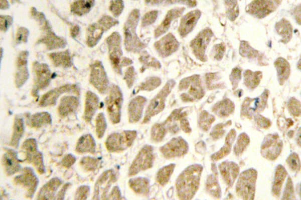 Polyclonal Rabbit anti-Human SIAH2 Antibody (Glu266, IHC, WB)