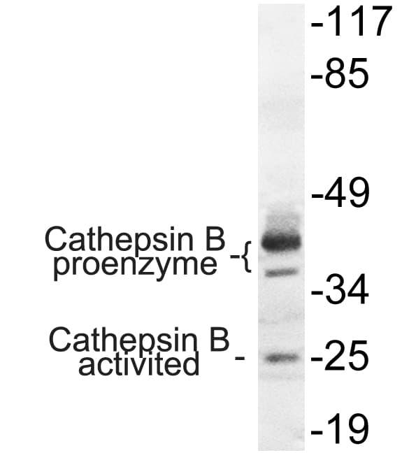 CTSB / Cathepsin B Antibody (aa168-217)