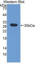 FGG / Fibrinogen Gamma Antibody (aa166-416)