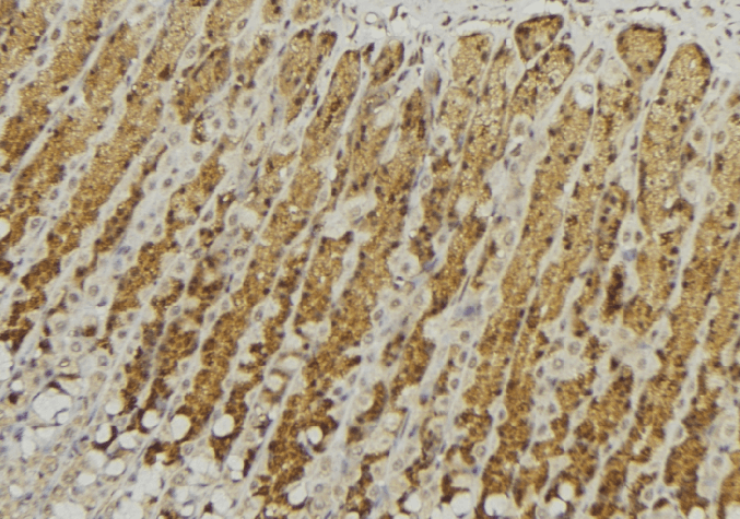 GALNS / Chondroitinase Antibody