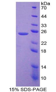 Mouse GSN / Gelsolin Protein (Recombinant His-T7)