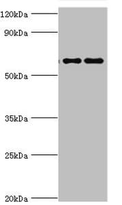 Polyclonal Rabbit anti-Human FUBP3 Antibody (aa65-260, IHC, WB)