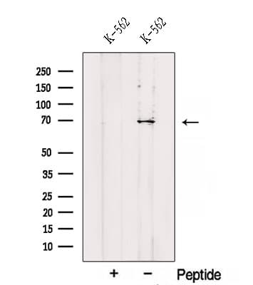 RHOT2 Antibody