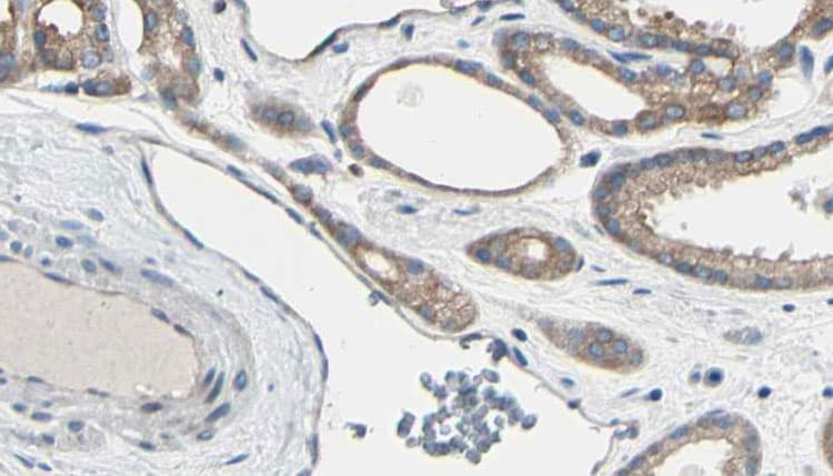 Polyclonal Rabbit anti-Human LIPE / HSL Antibody (phospho-Ser855,phospho-Ser554, IHC, IF, WB)