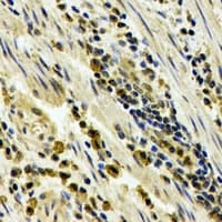 Polyclonal Rabbit anti-Human STAU1 / Staufen Antibody (IHC, WB)