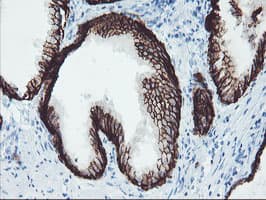 FXYD3 Antibody (clone OTI1F12)