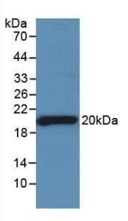 SHBG Antibody (aa222-358)