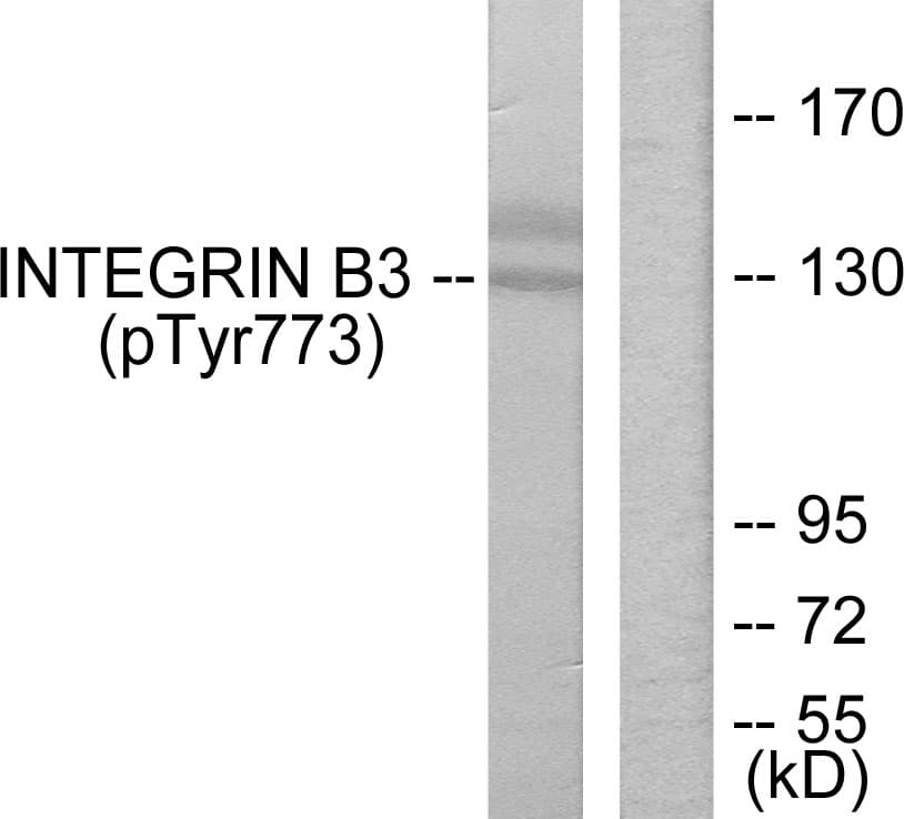 ITGB3 / Integrin Beta 3 / CD61 Antibody (phospho-Tyr773)