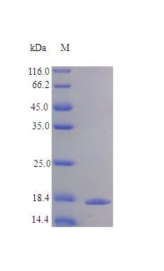 Human IL19 Protein (Recombinant)