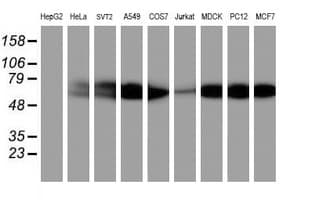 AKT1 Antibody (clone OTI4G4)