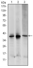 MAP2K6 / MEK6 / MKK6 Antibody (clone 3H12C8)