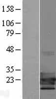 TCF21 / Epicardin Protein (Over-Expression Lysate Myc-DDK (Flag))